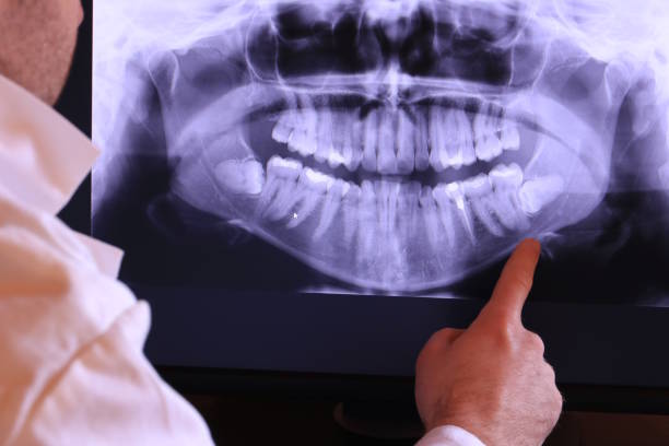 Best Emergency TMJ Treatment in Fris, CO