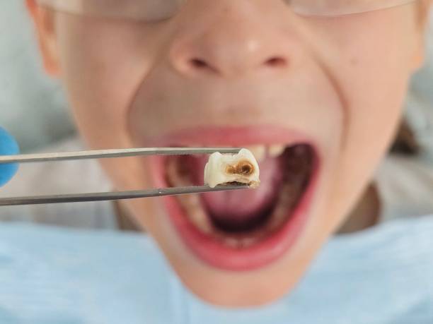 Best Pediatric Emergency Dentist in Fris, CO