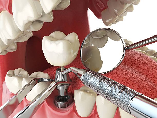 Best Emergency Treatment for Dental Infections or Abscesses in Fris, CO